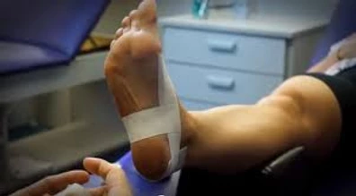 Shin Splints