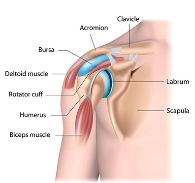 Bursitis